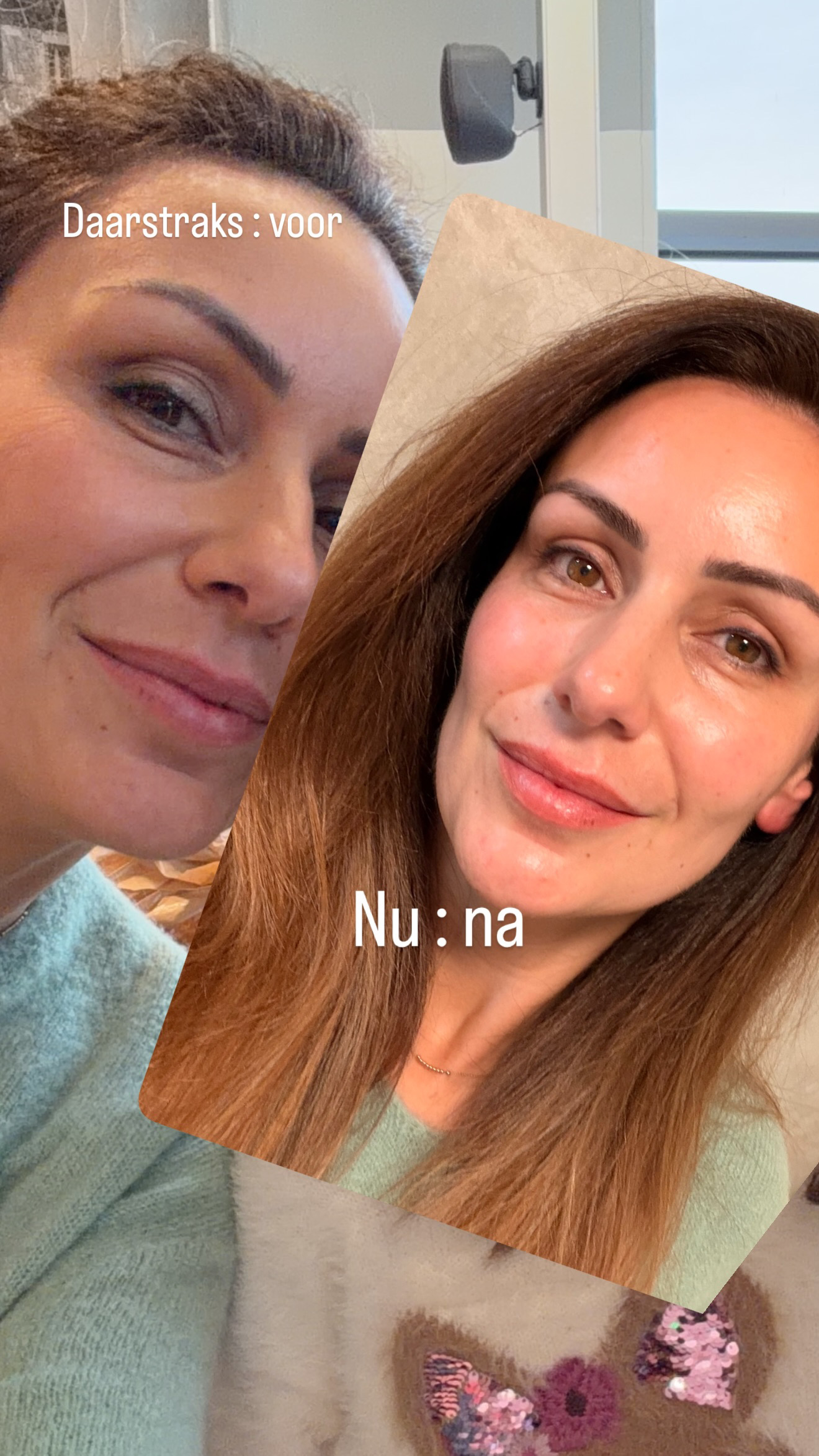 Bio-Collageen Real Deep Masker - DOOSJE MET 4 STUKS - Afbeelding 4